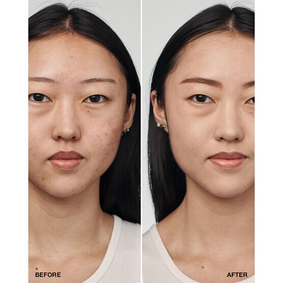 CLINIQUE   EVEN BETTER   FOUN 30ML
